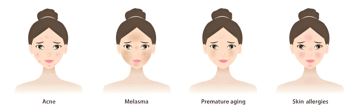 Types of Dark Spots